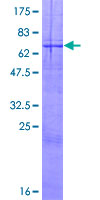 12.5% SDS-PAGE Stained with Coomassie Blue.